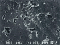 SEM observation of FE cross section (x1000)